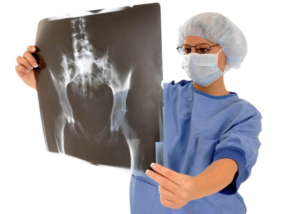 تساعد الأشعة السينية لمفصل الورك الطبيب على تحديد سبب الألم